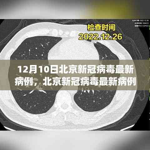 北京新冠病毒最新病例分析報告,深度解讀(截至12月10日)